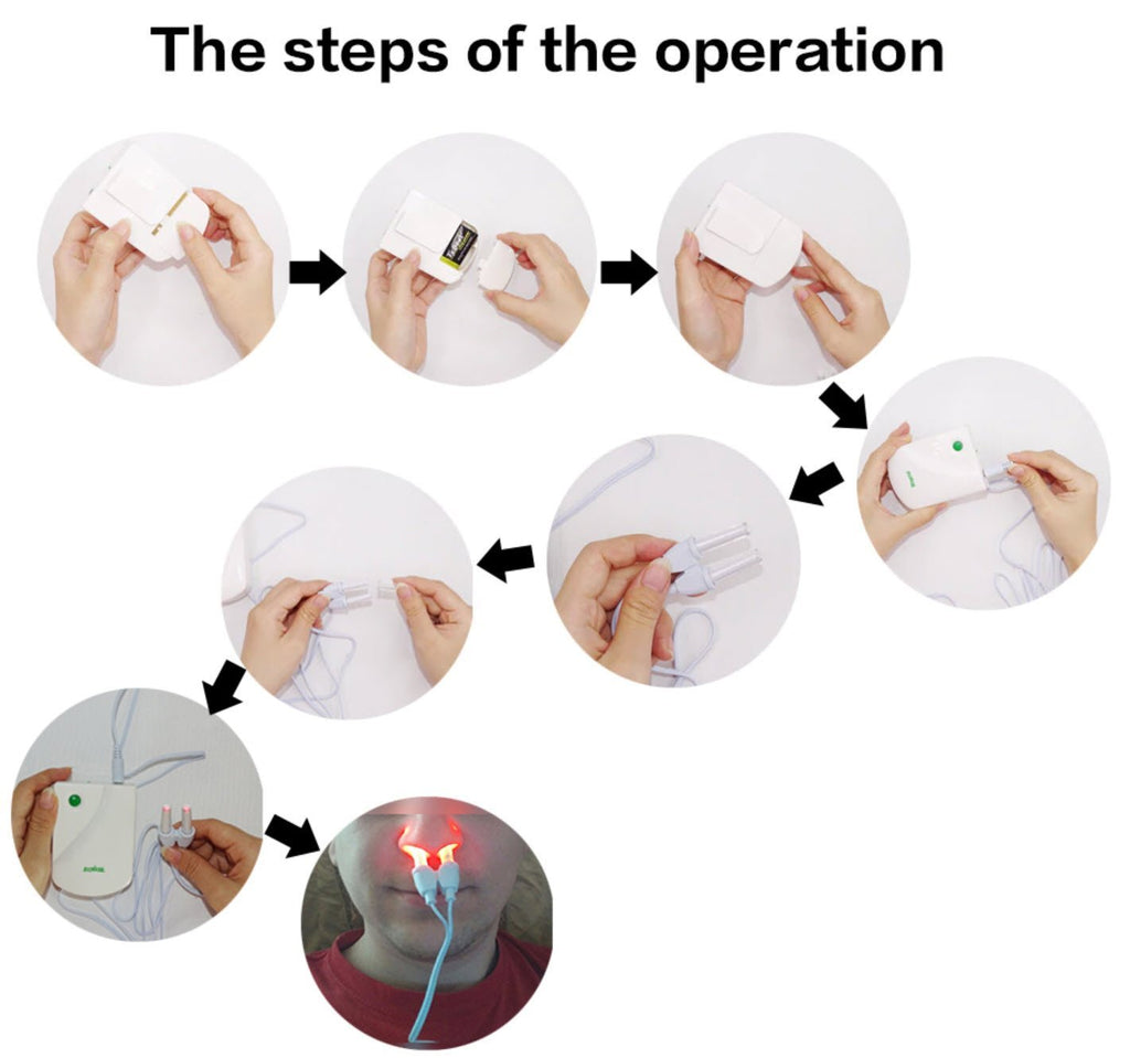 Infrarood Rhinitis Therapieapparaat | Effectieve Verlichting voor Allergieën